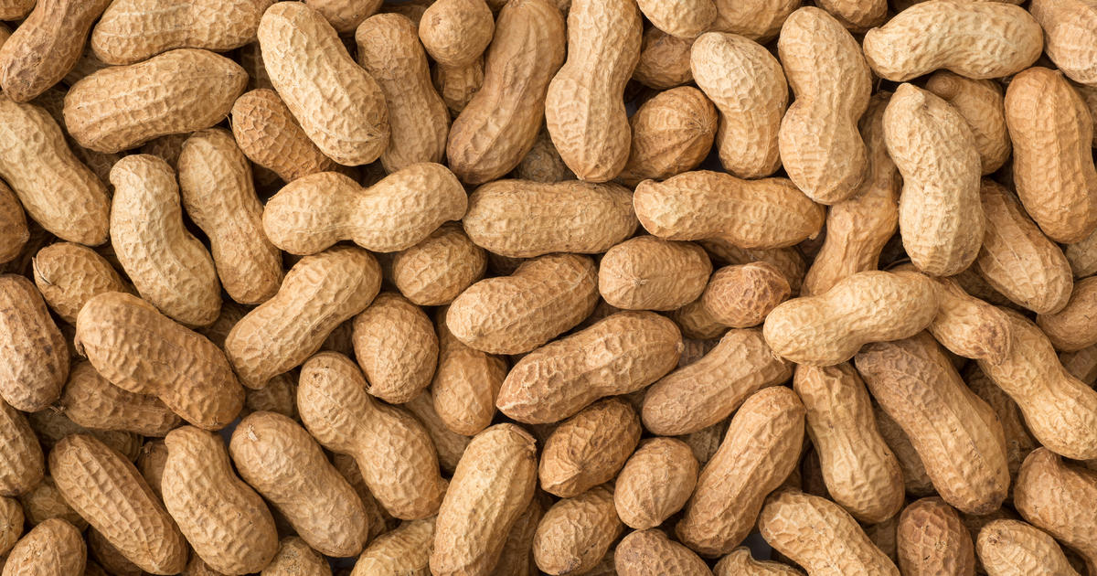 Peanut allergy patch for toddlers shows promise, study finds